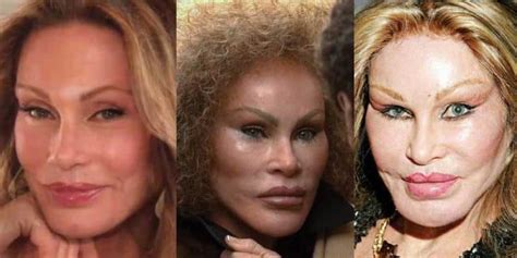 Jocelyn Wildenstein Plastic Surgery Before And After Face Photos