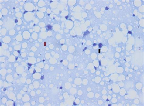 Presence of cellular debris on a basophilic background (red arrow) with... | Download Scientific ...