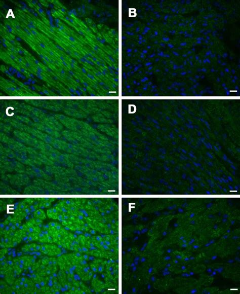 Immunofluorescence staining of the mitochondrial network in myocardial ...