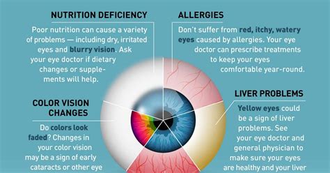 Infographic: 10 Health Problems Your Eyes Could Be Showing Signs Of | Vision Art Eye Care