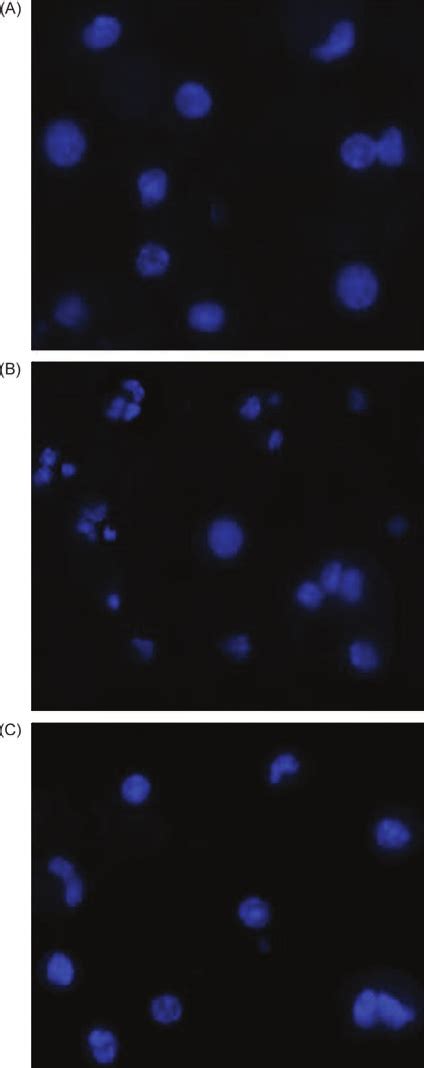 Detection of the mode of cell death by DAPI staining assay. DAPI ...