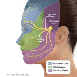 Facial Nerve Pain can be Managed with Effective Treatment - Healthy Life Dental