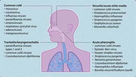 Upper respiratory tract infections | Musculoskeletal Key