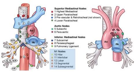 Lung Lymph Nodes Anatomy Lung Cancer