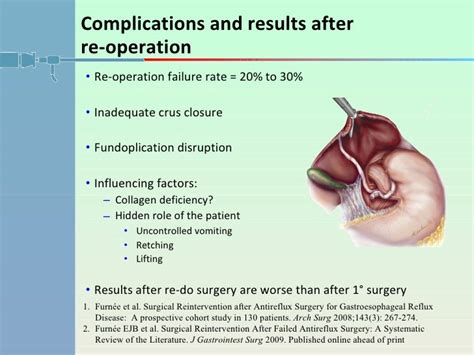 Complications Following Antireflux Surgery: Recognition and Management