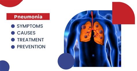 Pneumonia: Symptoms, Causes, Treatment, and Prevention