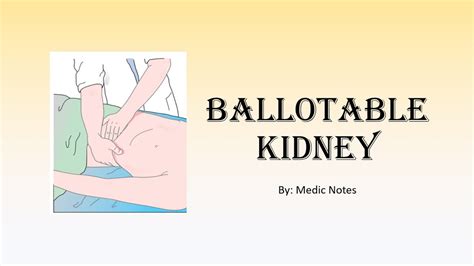 Ballotable kidney mechanism, unilateral vs bilateral causes - YouTube