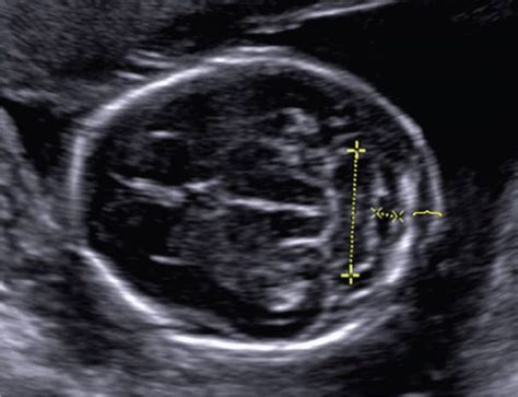 Fetal Imaging | Obgyn Key