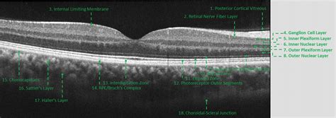 Is OCT for me? - Lakeside Ophthalmology Center.