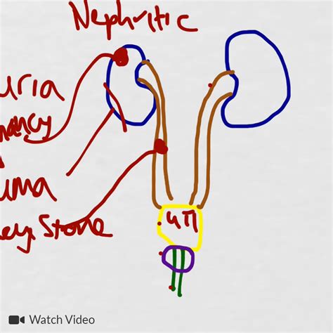 Differential Diagnosis of Macroscopic Hematuria