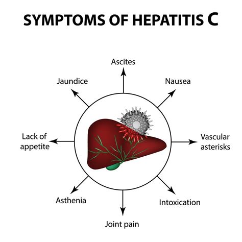 Hepatitis C Symptoms - Image to u