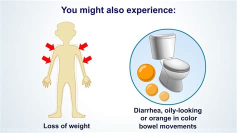 Pin on Animated Pancreas Patient