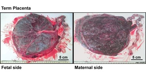 Placenta Development - Embryology