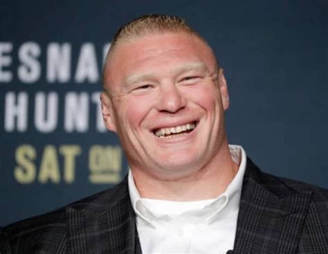 Brock Lesnar Teeth Fixed 2023, Before and After