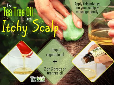 How To Get Rid Of Itchy Scalp Home Remedy