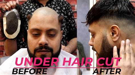 Hair Patch Under Cut Hair Style | Hair Patches For Men | Hair Transformation - YouTube