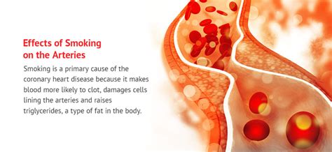 How Smoking Affects Your Heart - Modern Heart and Vascular