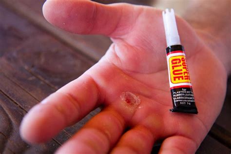 Why Use Super Glue? | Survival Life