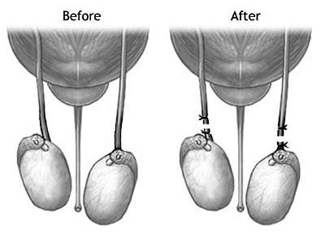 In-Office Procedures | Urologist - Dr. Salman S. Razi, M.D.