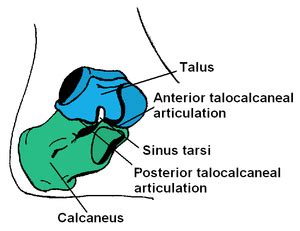 Subtalar dislocation - WikEM