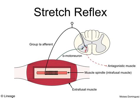 Muscle Spindles / Golgi Tendon Organs - Neurology - Medbullets Step 1