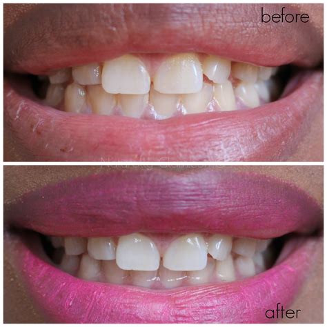 Colgate Optic White Before and After | Naturally Glam | Jonna Scott-Blakes