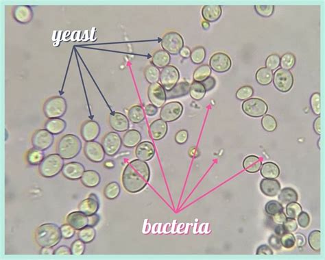 How to tell the difference between Yeast & Bacteria: Visual Comparison — NEAT