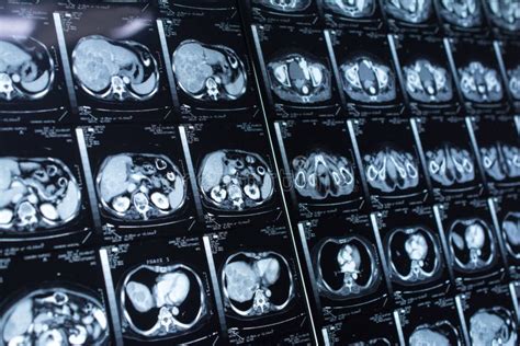 143 Ct Scan Brain Contrast Media Stock Photos - Free & Royalty-Free Stock Photos from Dreamstime