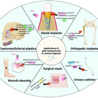 Applications of gold nanoparticles in various implants. | Download ...