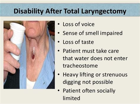 Diagnosis and treatment of carcinoma of larynx by nitesh Kr.