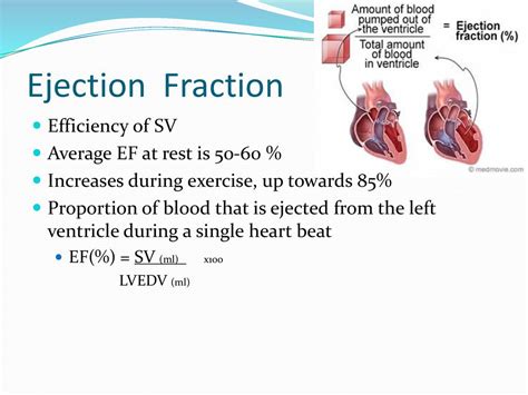 Assessing Left Ventricular Ejection Fraction With, 49% OFF