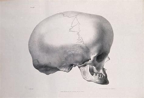 The deformed skull of James Cardinal: profile view free public domain ...