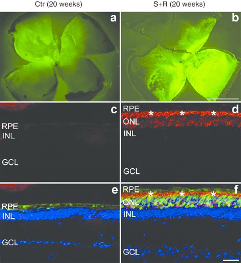 Immunohistochemical analysis of rhodopsin expression following combined ...