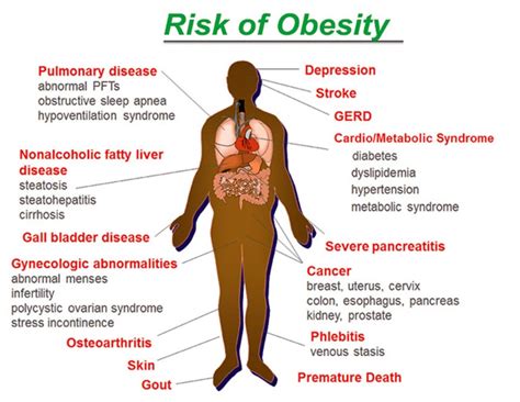 Obesity And Growing Health Risks everyone should know - Doctor ASKY