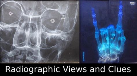 MSK Radiograph Views Dummy Version by UW Department of Radiology - Issuu