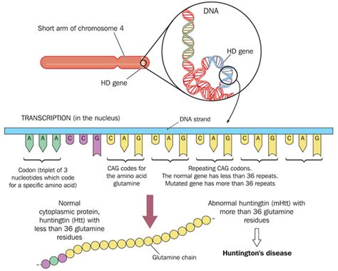 Huntington's Disease - Causes, Symptoms, Diagnosis and Treatment