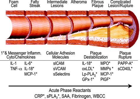 Biomarkers of Atherosclerotic Plaque Instability and Rupture | Arteriosclerosis, Thrombosis, and ...