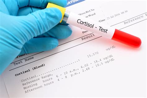 Lab Evaluation: Adrenal Fatigue and Cortisol Test