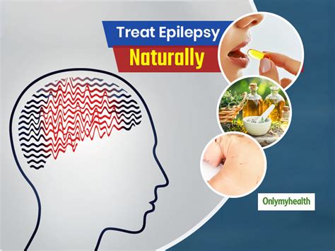 International Epilepsy Day: Is Natural Treatment Of Epilepsy Possible? | OnlyMyHealth