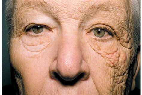 This photo shows what 28 years of sun damage does to your face | The Independent