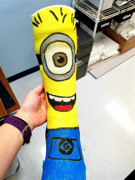 Minion painted leg cast | Leg cast, Cast decoration, It cast