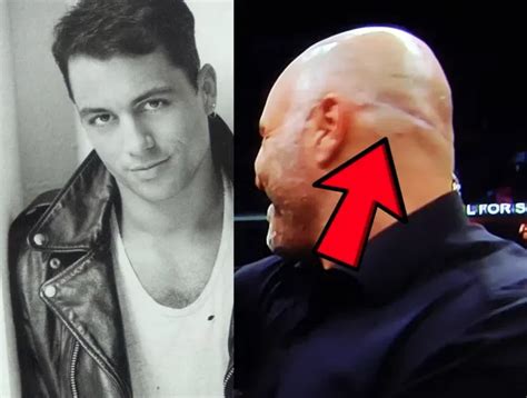 The Story Behind Joe Rogan's Hair Transplant - Hair System