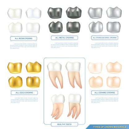 Infographics Types Of Dental Crown Materials With Healthy Teeth Stock Illustration - Download ...