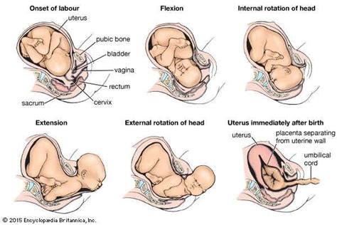 Image result for flexion movements of labour ppt