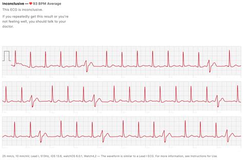 My mother has been having a fast heartbeat for the last couple of days. Today I noticed skipped ...