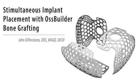 Simultaneous Implant Placement with OssBuilder Bone Grafting – Advanced Dental Implant Research ...