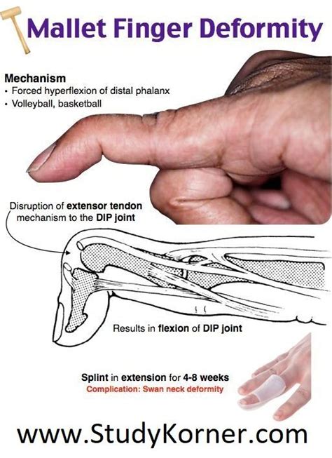 Pin on Physical Therapy