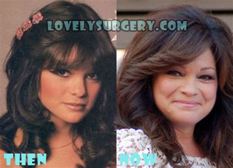 Valerie Bertinelli Plastic Surgery Before and After Rumor - Lovely Surgery