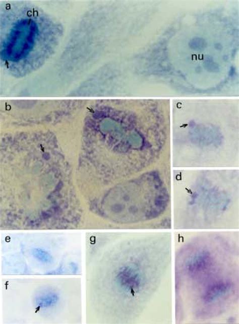 Metachromatic staining of interphase cell nucleoli (nu) (a, b),... | Download Scientific Diagram