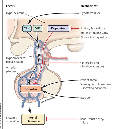 Evaluation and Management of Galactorrhea | AAFP